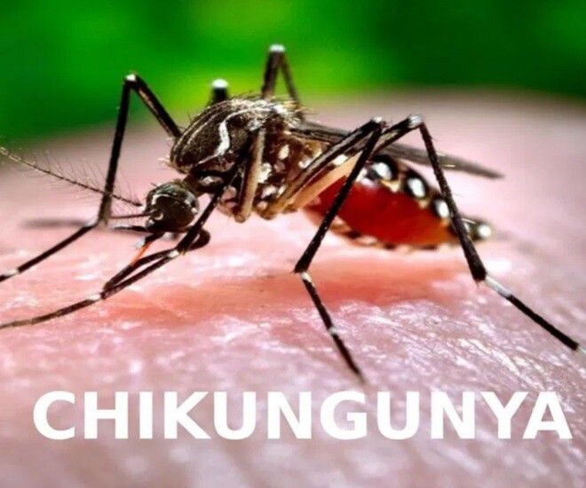 Chikungunya