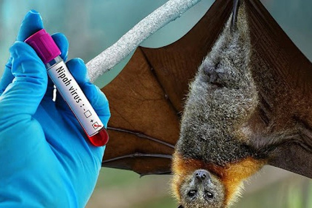 Nếu Virus Nipah Đến ?